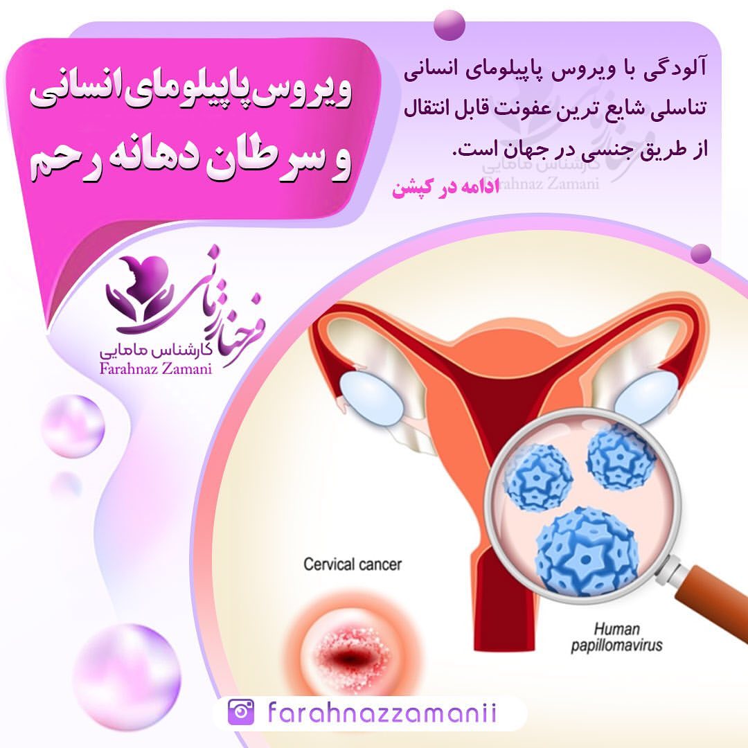 hpv و سرطان دهانه رحم