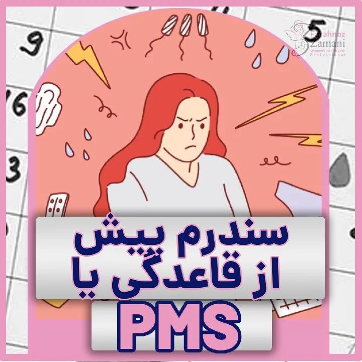 سندرم پیش از قاعدگی